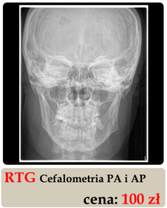 Rentgen na dworcu. RTG Cefalometria PA i AP